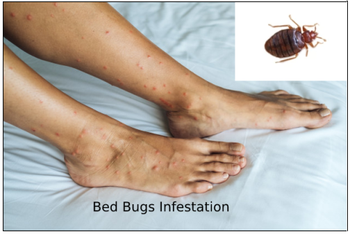 Tips To Fight Bed Bugs Infestation